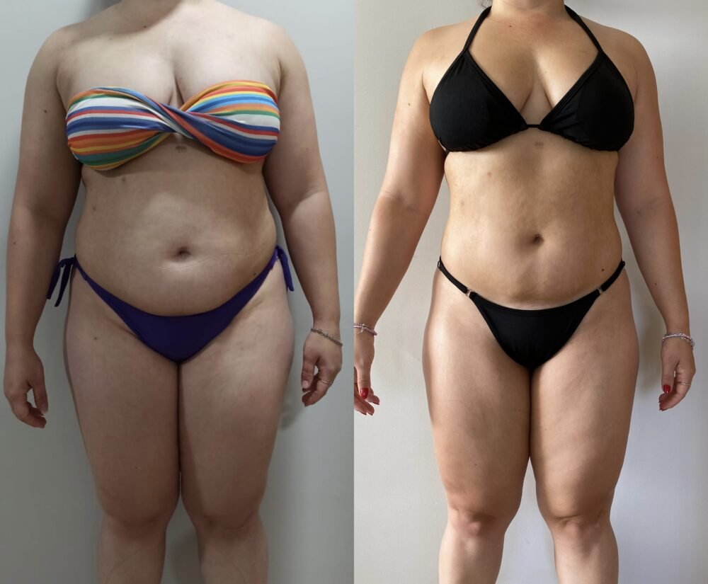 Transformação 6 da consultoria do Studio Bianco Bodybuilder