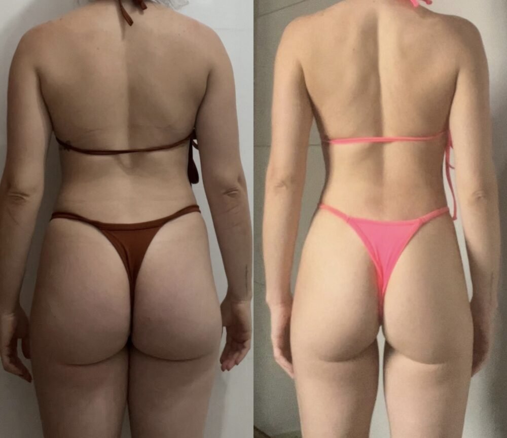Transformação 3 da consultoria do Studio Bianco Bodybuilder